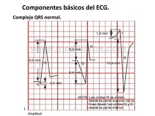 Componentes básicos del ECG.
Complejo QRS normal.
 