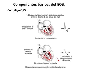 Componentes básicos del ECG.
Complejo QRS.
 