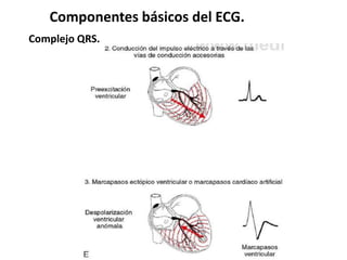 Componentes básicos del ECG.
Complejo QRS.
 