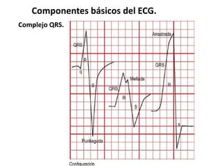 Componentes básicos del ECG.
Complejo QRS.
 