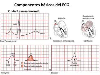 Componentes básicos del ECG.
Onda P sinusal normal.
 