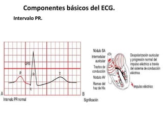 Componentes básicos del ECG.
Intervalo PR.
 