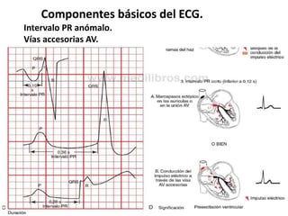 Componentes básicos del ECG.
Intervalo PR anómalo.
Vías accesorias AV.
 
