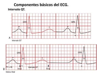 Componentes básicos del ECG.
Intervalo QT.
 