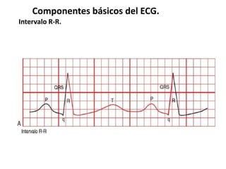 Componentes básicos del ECG.
Intervalo R-R.
 