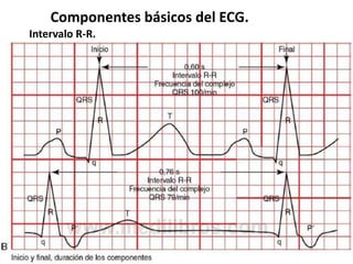 Componentes básicos del ECG.
Intervalo R-R.
 