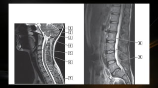 Componentes del Sistema Nervisos Central