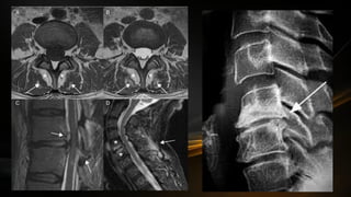 Componentes del Sistema Nervisos Central
