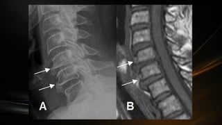 Componentes del Sistema Nervisos Central