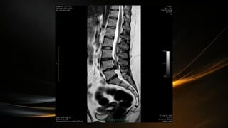 Componentes del Sistema Nervisos Central