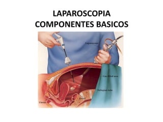 LAPAROSCOPIA
COMPONENTES BASICOS
 