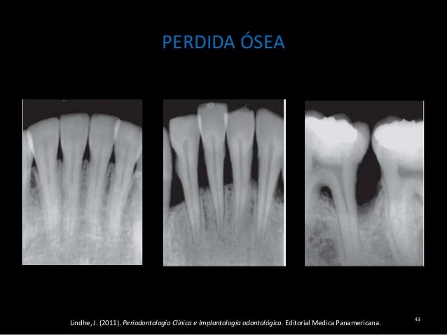 Componentes de un diagnóstico periodontal y plan de tratamiento.