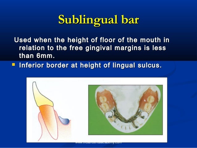 Component parts of cast partial dentures / orthodontic courses
