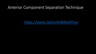 Anterior Component Separation Technique
https://youtu.be/esXHBWuHY1w
 