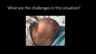 What are the challenges in this situation?
 