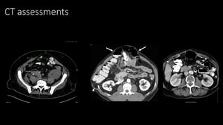 CT assessments
 