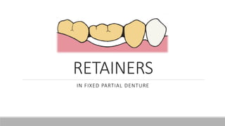 RETAINERS
IN FIXED PARTIAL DENTURE
 