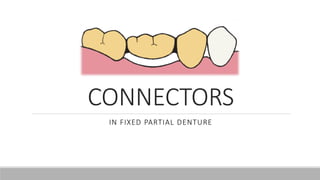 CONNECTORS
IN FIXED PARTIAL DENTURE
 