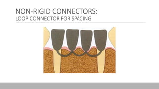 NON-RIGID CONNECTORS:
LOOP CONNECTOR FOR SPACING
 