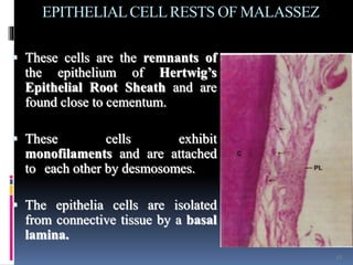EPITHELIALCELLRESTS OF MALASSEZ
 These cells are the remnants of
the epithelium of Hertwig’s
Epithelial Root Sheath and are
found close to cementum.
 These cells exhibit
monofilaments and are attached
to each other by desmosomes.
 The epithelia cells are isolated
from connective tissue by a basal
lamina.
13
 
