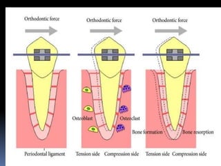 Components of periodontal ligament.pptx