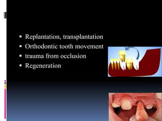  Replantation, transplantation
 Orthodontic tooth movement
 trauma from occlusion
 Regeneration
 