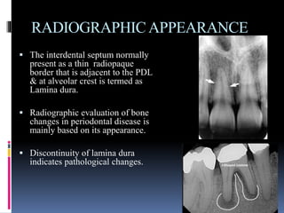 RADIOGRAPHICAPPEARANCE
 The interdental septum normally
present as a thin radiopaque
border that is adjacent to the PDL
& at alveolar crest is termed as
Lamina dura.
 Radiographic evaluation of bone
changes in periodontal disease is
mainly based on its appearance.
 Discontinuity of lamina dura
indicates pathological changes.
 