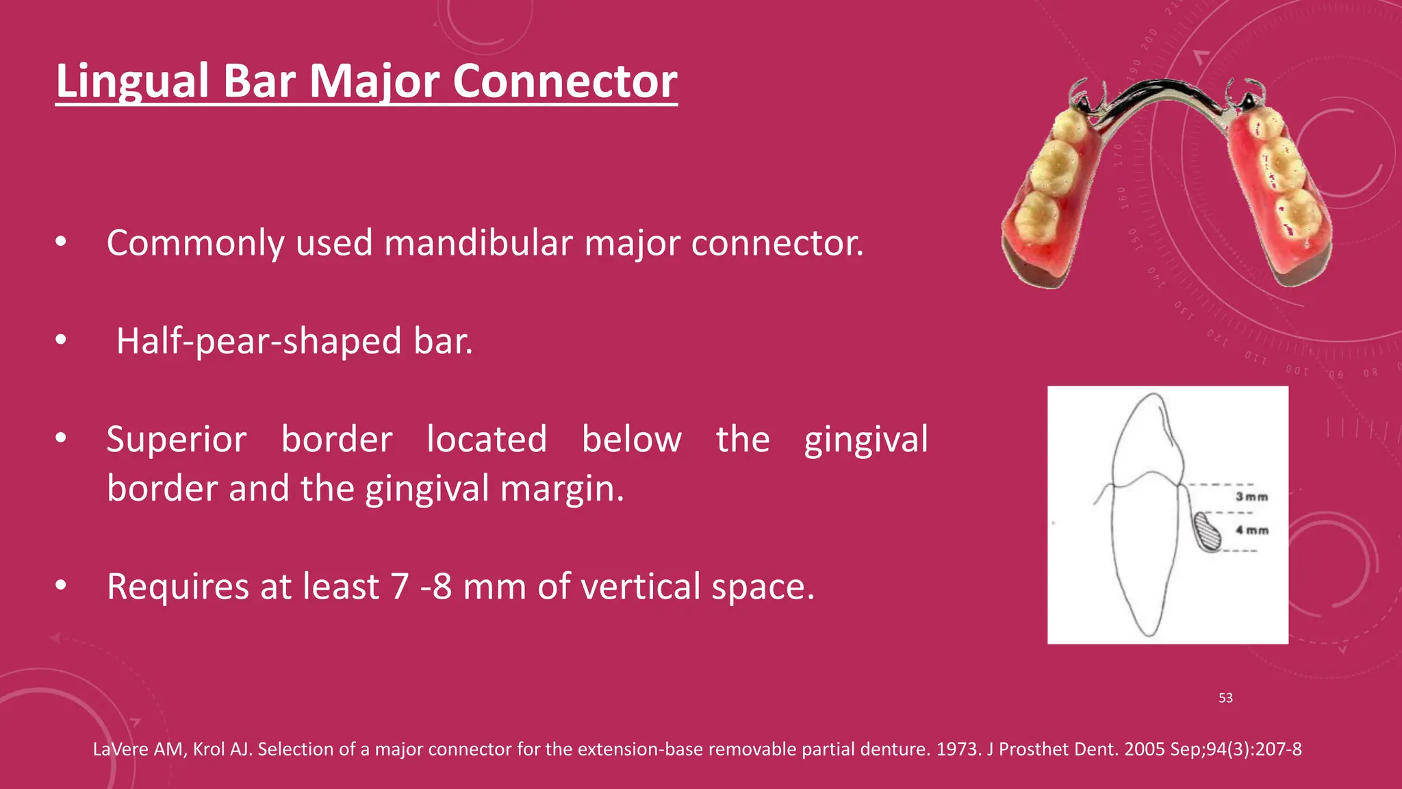Components of RPD and Major connectors_Dr Shuchi Jain.pptx