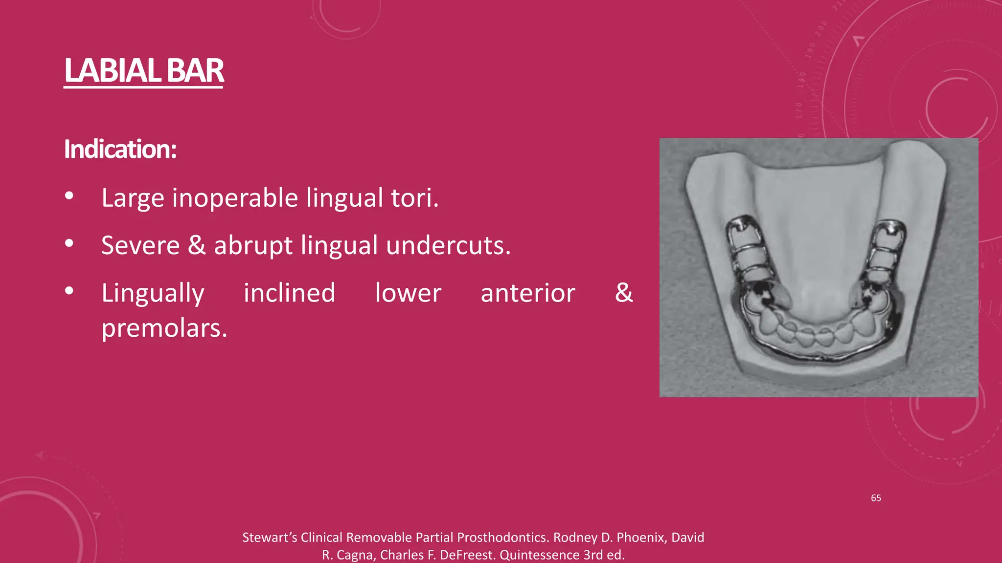 Components of RPD and Major connectors_Dr Shuchi Jain.pptx
