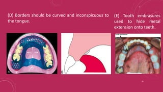 Tooth Lrpd Components of RPD and Major connectors_Dr Shuchi Jain.pptx