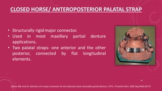 Posterier Strap Rpd Components of RPD and Major connectors_Dr Shuchi Jain.pptx