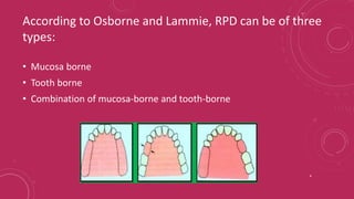 Components of RPD and Major connectors_Dr Shuchi Jain.pptx