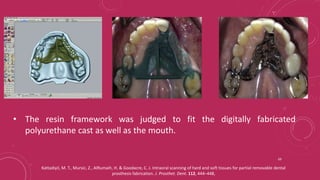 Resin Rest Rpd Components of RPD and Major connectors_Dr Shuchi Jain.pptx