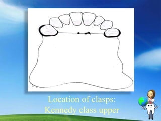 Component Parts of A Partial Denture | PPTX