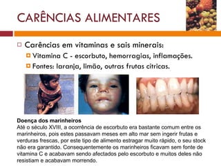 Carências em vitaminas e sais minerais: Vitamina C - escorbuto, hemorragias, inflamações. Fontes: laranja, limão, outras frutas cítricas.  CARÊNCIAS ALIMENTARES Doença dos marinheiros    Até o século XVIII, a ocorrência de escorbuto era bastante comum entre os marinheiros, pois estes passavam meses em alto mar sem ingerir frutas e verduras frescas, por este tipo de alimento estragar muito rápido, o seu stock não era garantido. Consequentemente os marinheiros ficavam sem fonte de vitamina C e acabavam sendo afectados pelo escorbuto e muitos deles não resistiam e acabavam morrendo.  