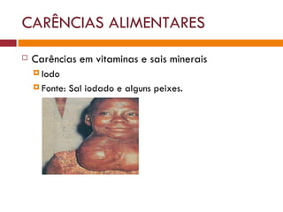CARÊNCIAS ALIMENTARES Carências em vitaminas e sais minerais Iodo  Fonte: Sal iodado e alguns peixes. 