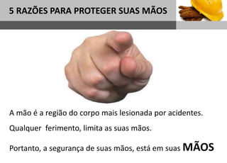 1
5 RAZÕES PARA PROTEGER SUAS MÃOS
Sub headline
A mão é a região do corpo mais lesionada por acidentes.
Qualquer ferimento, limita as suas mãos.
Portanto, a segurança de suas mãos, está em suas MÃOS
 