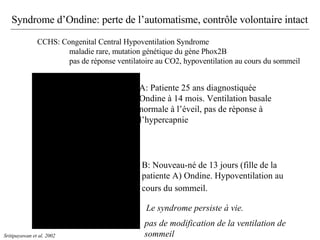 Syndrome d’Ondine: perte de l’automatisme, contrôle volontaire intact Sritipayawan et al. 2002 A: Patiente 25 ans diagnostiquée Ondine à 14 mois. Ventilation basale normale à l’éveil, pas de réponse à l’hypercapnie B: Nouveau-né de 13 jours (fille de la patiente A) Ondine. Hypoventilation au cours du sommeil.   CCHS: Congenital Central Hypoventilation Syndrome maladie rare, mutation génétique du gène Phox2B pas de réponse ventilatoire au CO2, hypoventilation au cours du sommeil pas de modification de la ventilation de sommeil Le syndrome persiste à vie. 