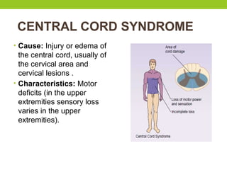 CENTRAL CORD SYNDROME
• Cause: Injury or edema of
the central cord, usually of
the cervical area and
cervical lesions .
• Characteristics: Motor
deficits (in the upper
extremities sensory loss
varies in the upper
extremities).
 