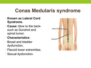 Conas Medularis syndrome
• Known as Lateral Cord
Syndrome.
• Cause: blow to the back-
such as Gunshot and
spinal tumor.
• Characteristics:
• Bowel and bladder
dysfunction,
• Flaccid lower extremities.
• Sexual dysfunction.
 