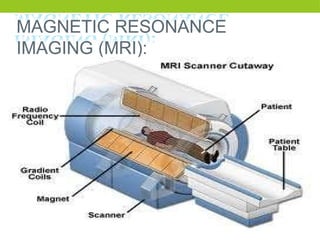 MAGNETIC RESONANCE
IMAGING (MRI):
 