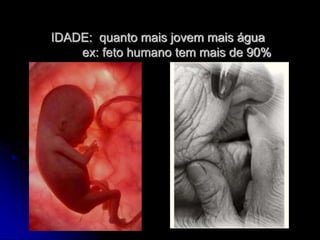IDADE: quanto mais jovem mais água
ex: feto humano tem mais de 90%
 