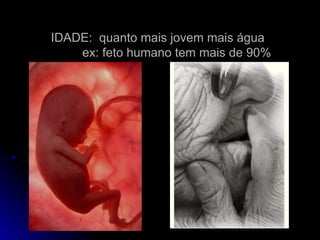 IDADE: quanto mais jovem mais água
IDADE: quanto mais jovem mais água
ex: feto humano tem mais de 90%
ex: feto humano tem mais de 90%
 