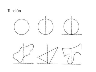 Tensión
 