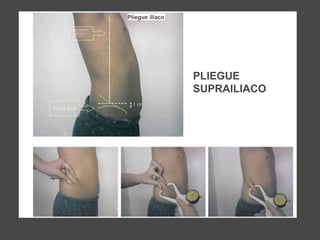 Pliegue iliaco
ea axilar
Interior
PLIEGUE
SUPRAILIACO
 
