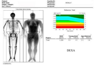 DEXA
 