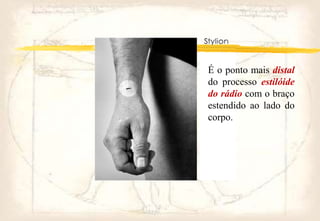 É o ponto mais distal
do processo estilóide
do rádio com o braço
estendido ao lado do
corpo.
 