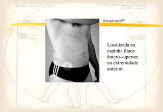 Localizada na
espinha ilíaca
ântero-superior.
na extremidade
anterior.
 