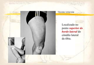 Localizado no
ponto superior do
bordo lateral do
côndilo lateral
da tíbia.
 