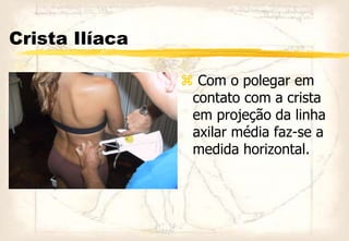 Crista Ilíaca
 Com o polegar em
contato com a crista
em projeção da linha
axilar média faz-se a
medida horizontal.
 